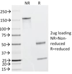 Caldesmon/CALD1 Antibody (h-CALD), Novus Biologicals 0.2mg; Unlabeled:Antibodies,
